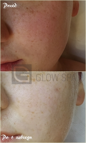 BB Glow Bydgoszcz - GlowSpa